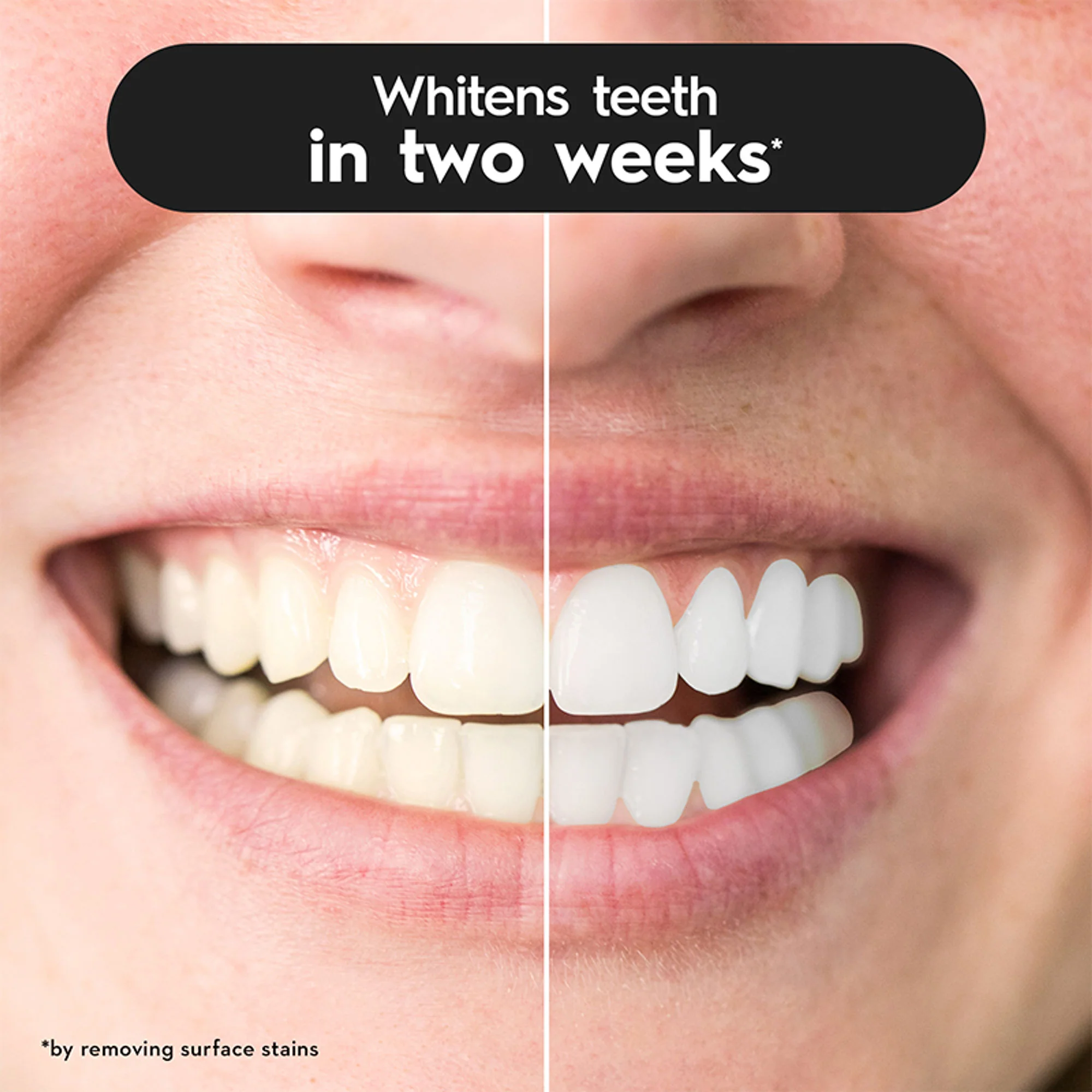 Oral-B 3D White Charcoal Soft Toothbrush For Adults (Pack Of 2) - Image 3